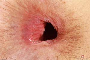 Original 3000 px/ 2000 px