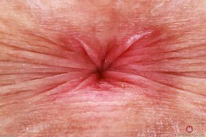 Original 3000 px/ 1999 px