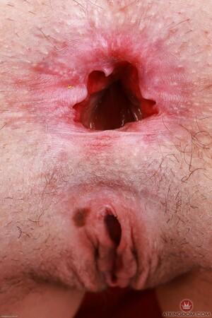 Original 682 px/ 1024 px