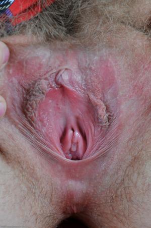 Original 1063 px/ 1600 px