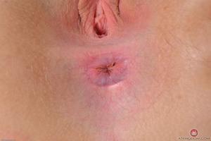 Original 3000 px/ 2000 px