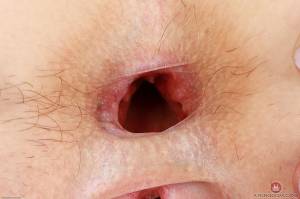 Original 3000 px/ 1999 px