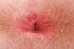 Original 3000 px/ 2000 px