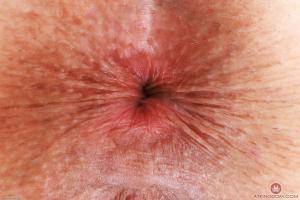 Original 3000 px/ 2000 px