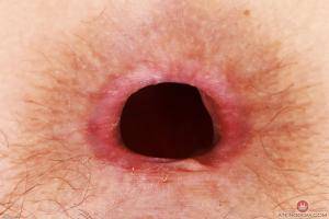 Original 3000 px/ 2000 px