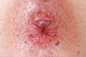 Original 5000 px/ 3333 px