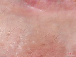 Original 3000 px/ 2260 px