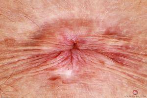 Original 3000 px/ 2000 px