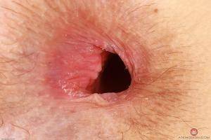 Original 3000 px/ 2000 px