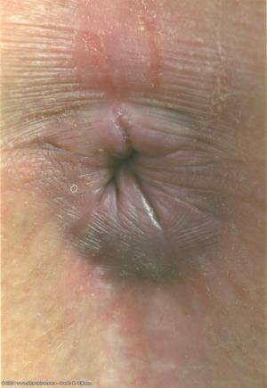 Original 682 px/ 990 px