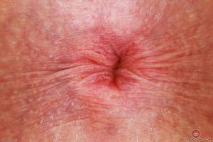 Original 3000 px/ 2000 px