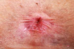 Original 3000 px/ 2000 px