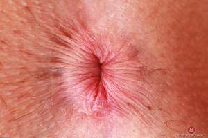 Original 3000 px/ 2000 px