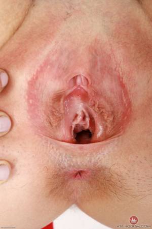 Original 2000 px/ 3000 px