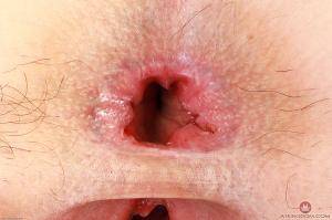 Original 3000 px/ 1999 px