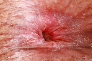 Original 5000 px/ 3333 px