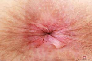 Original 3000 px/ 2000 px