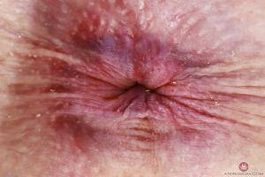 Original 3000 px/ 2000 px