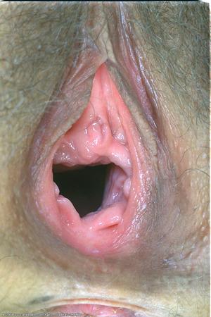 Original 682 px/ 1024 px