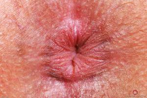 Original 3000 px/ 2000 px