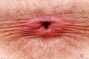 Original 3000 px/ 2000 px