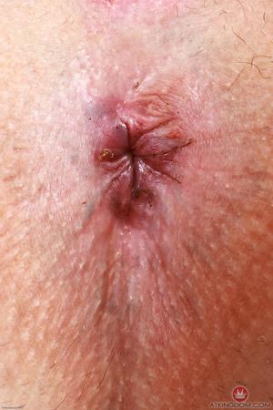 Original 2000 px/ 3000 px