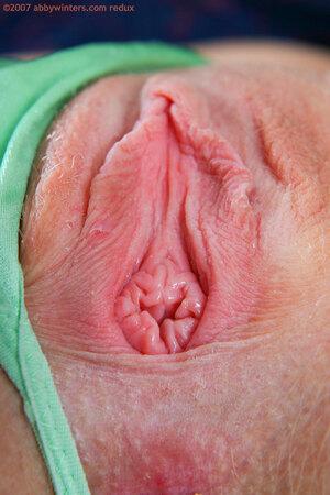 Original 981 px/ 1472 px