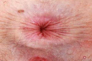 Original 3000 px/ 2000 px