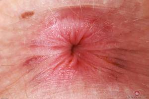 Original 3000 px/ 2000 px