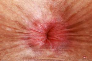 Original 3000 px/ 2000 px