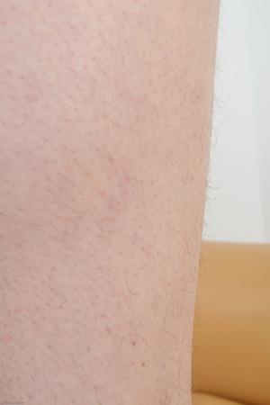 Original 2000 px/ 3000 px