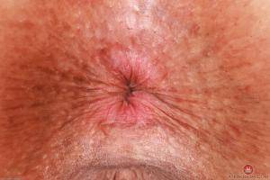 Original 3000 px/ 2000 px