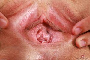 Original 3000 px/ 2000 px