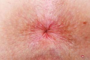 Original 3000 px/ 2000 px