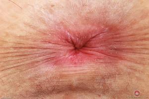 Original 3000 px/ 2000 px