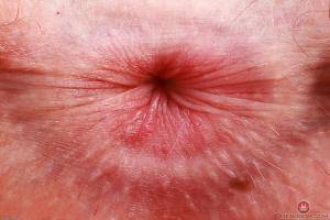 Original 3000 px/ 2000 px