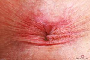 Original 3000 px/ 2000 px