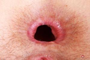 Original 3000 px/ 2000 px