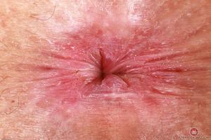 Original 3000 px/ 2000 px