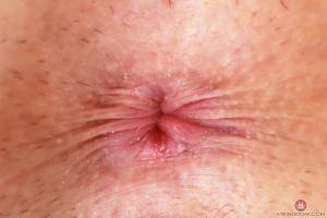 Original 3000 px/ 2000 px