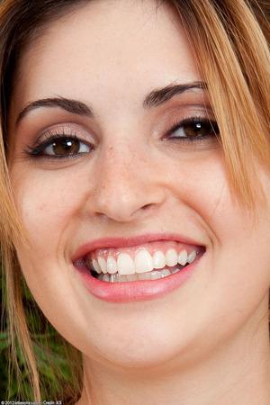 Original 756 px/ 1134 px