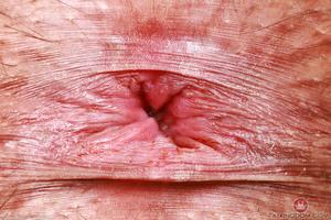 Original 5000 px/ 3333 px