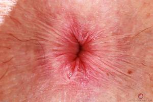 Original 3000 px/ 2000 px