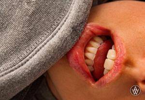 Original 2304 px/ 1595 px