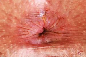 Original 3000 px/ 2000 px