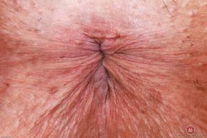 Original 3000 px/ 2000 px