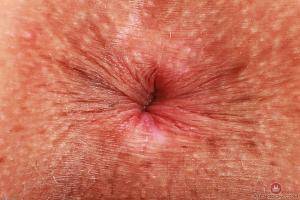 Original 3000 px/ 2000 px