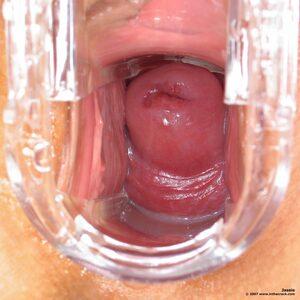 Original 1400 px/ 1400 px