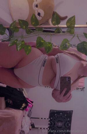 Original 1008 px/ 1545 px