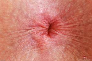 Original 3000 px/ 2000 px